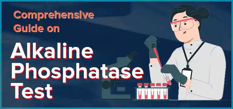 Comprehensive Guide on Alkaline Phosphatase Test